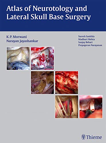 

exclusive-publishers/thieme-medical-publishers/atlas-of-neurotology-and-lateral-skull-base-surgery--9789382076933