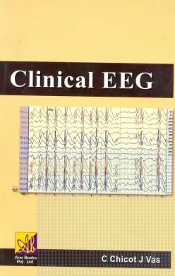 exclusive-publishers/other/clinical-eeg--9789382127420