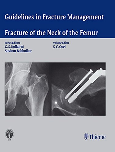 

exclusive-publishers/thieme-medical-publishers/guidelines-in-fracture-management---fracture-of-the-neck-of-the-femur--9789385062094
