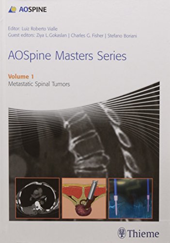 

exclusive-publishers/thieme-medical-publishers/aospine-masters-series-volume-1-metastatic-spinal-tumors-1-e--9789385062162