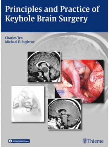 

surgical-sciences/nephrology/principles-and-practice-of-keyhole-brain-surgery-1st-ed-9789385062438