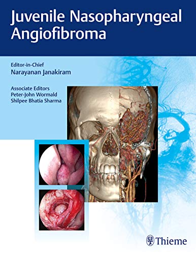 

exclusive-publishers/thieme-medical-publishers/juvenile-nasopharyngeal-angiofibroma--9789385062766