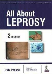 

best-sellers/jaypee-brothers-medical-publishers/all-about-leprosy-9789385891960