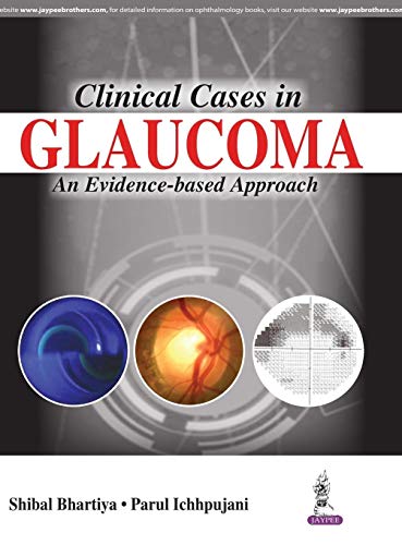 

best-sellers/jaypee-brothers-medical-publishers/clinical-cases-in-glaucoma-an-evidence-based-approach-9789386056962