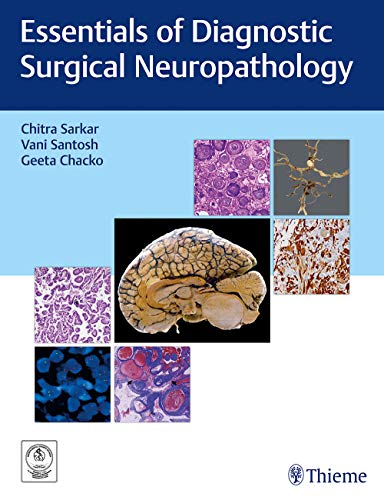 

exclusive-publishers/thieme-medical-publishers/essentials-of-diagnostic-surgical-neuropathology--9789386293350