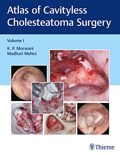 

exclusive-publishers/thieme-medical-publishers/atlas-of-cavityless-cholesteatoma-surgery-volume-1--9789386293411
