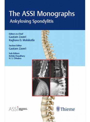

exclusive-publishers/thieme-medical-publishers/the-assi-monogarphs-ankylosing-spondylitis--9789386293497