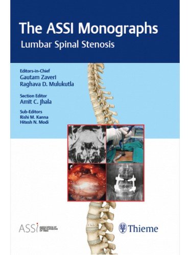 

exclusive-publishers/thieme-medical-publishers/association-of-spine-surgeons-of-indiamonograph-series-volume-1-lumbar-spinal-stenosis--9789386293510