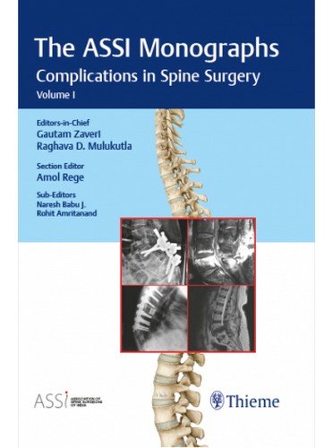 

exclusive-publishers/thieme-medical-publishers/the-assi-monogarphs-complications-in-spine-surgery-volume-1--9789386293534