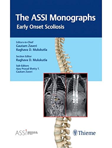 

exclusive-publishers/thieme-medical-publishers/the-assi-monogarphs-early-onset-scoliosis--9789386293923