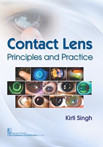 

best-sellers/cbs/contact-lens-principles-and-practice-pb-2017--9789386478061