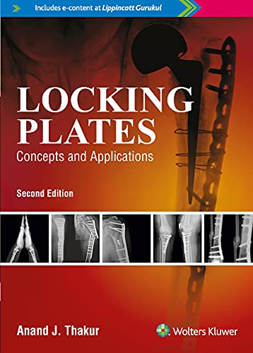 

mbbs/4-year/locking-plates-concepts-and-applications-2-ed-9789387963764