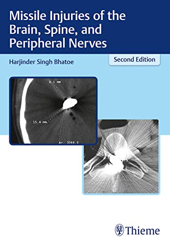 

exclusive-publishers/thieme-medical-publishers/missile-injuries-of-the-brain-spinal-cord-and-peripheral-nerves-2-e--9789388257107