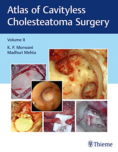 

exclusive-publishers/thieme-medical-publishers/atlas-of-cavityless-cholesteatoma-surgery-volume-ii--9789388257190