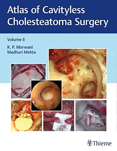 

exclusive-publishers/thieme-medical-publishers/atlas-of-cavityless-cholesteatoma-surgery-volume-ii--9789388257190