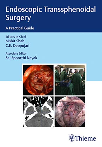 

exclusive-publishers/thieme-medical-publishers/endoscopic-transsphenoidal-surgery-practical-aspects--9789388257237