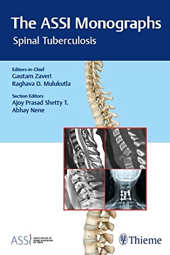 

exclusive-publishers/thieme-medical-publishers/the-assi-monogarphs-spinal-tuberculosis--9789388257329