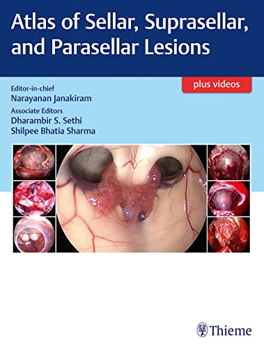 

exclusive-publishers/thieme-medical-publishers/atlas-of-sellar-suprasellar-and-parasellar-lesions-1-e--9789388257534