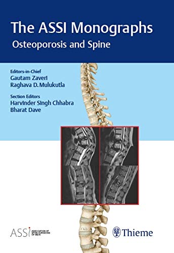 

exclusive-publishers/thieme-medical-publishers/the-assi-monogarphs-osteoporosis-and-spine--9789388257602