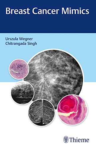 

exclusive-publishers/thieme-medical-publishers/breast-cancer-mimics--9789388257947