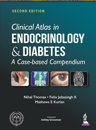 

best-sellers/jaypee-brothers-medical-publishers/clinical-atlas-in-endocrinology-diabetes-a-case-based-compendium-9789389587302