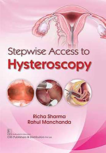 

best-sellers/cbs/stepwise-access-to-hysteroscopy-hb-2020--9789389688535