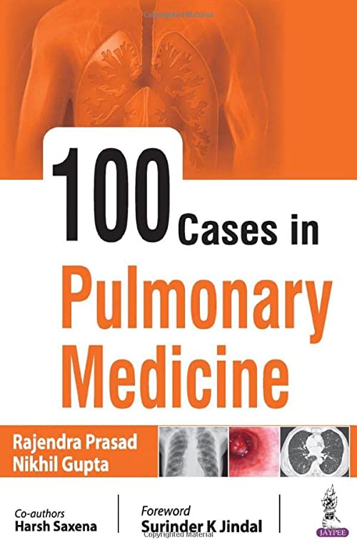 

best-sellers/jaypee-brothers-medical-publishers/100-cases-in-pulmonary-medicine-9789390020096