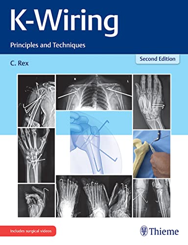 

exclusive-publishers/thieme-medical-publishers/k-wiring-principles-and-techniques-2ed--9789390553624