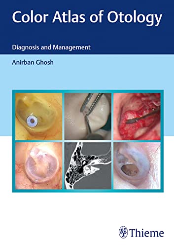 

exclusive-publishers/thieme-medical-publishers/color-atlas-of-otology--9789390553761