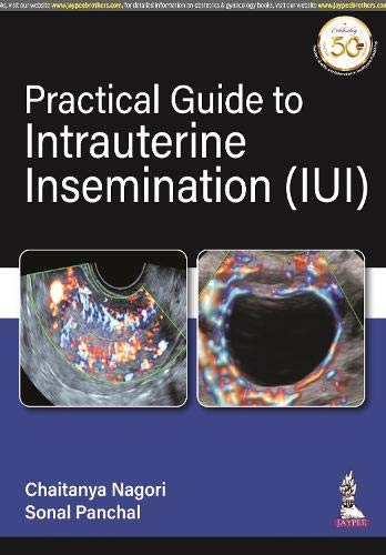 

best-sellers/jaypee-brothers-medical-publishers/practical-guide-to-intrauterine-insemination-iui--9789390595167