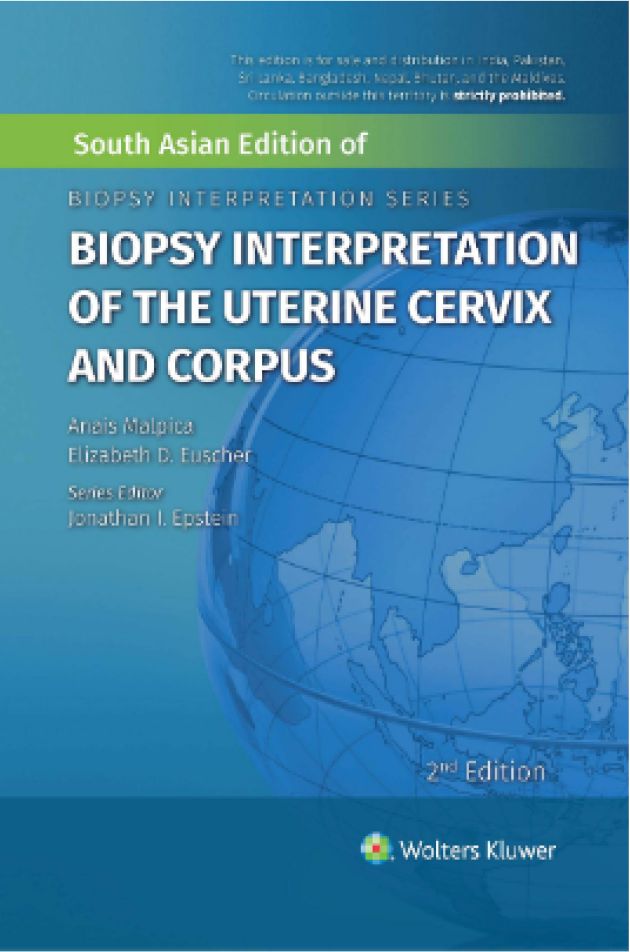 exclusive-publishers//biopsy-interpretation-of-the-uterine-cervix-and-corpus-9789390612147