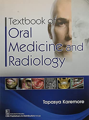 

best-sellers/cbs/textbook-of-oral-medicine-and-radiology-pb-2021--9789390709175