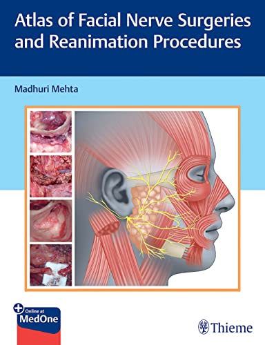 

exclusive-publishers/thieme-medical-publishers/atlas-of-facial-nerve-surgeries-and-reanimation-procedures-with-access-code-hb-2023--9789392819131