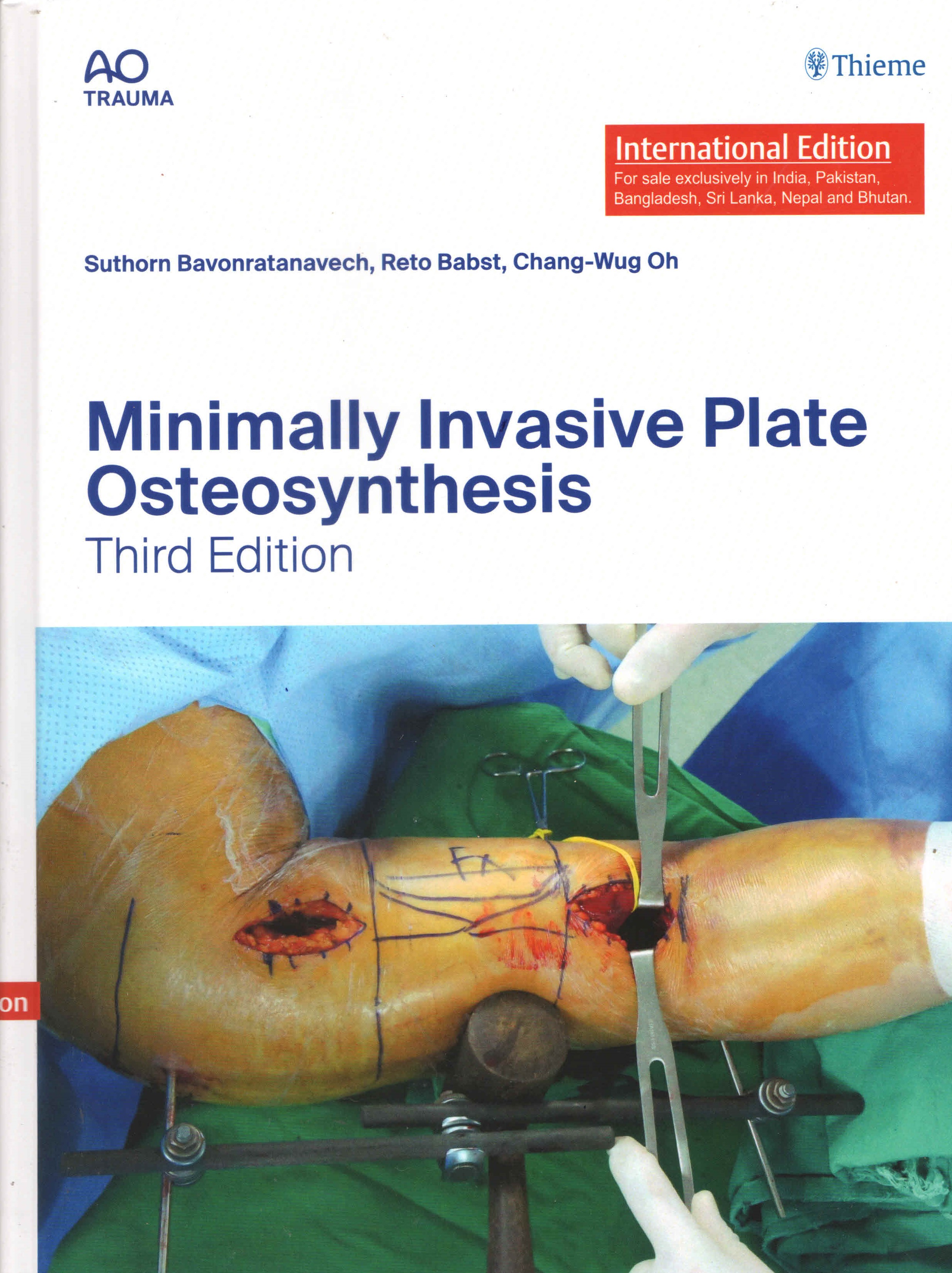 

exclusive-publishers/thieme-medical-publishers/minimally-invasive-plate-osteosynthesis-9789395390958