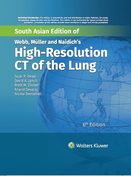 

clinical-sciences/respiratory-medicine/webb-m-ller-and-naidich-s-high-resolution-ct-of-the-lung-6-ed-9789395736008