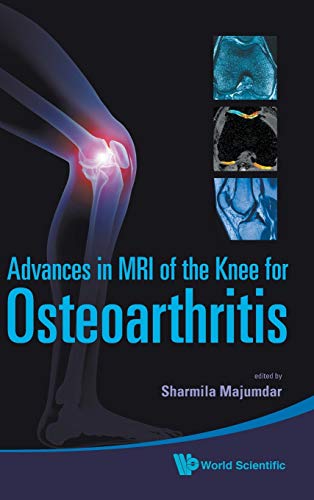 

surgical-sciences/orthopedics/adv-in-mri-of-the-knee-for-osteoarthriti-9789814271707