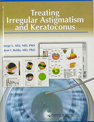 

surgical-sciences/ophthalmology/treating-irregular-astigmatism-and-keratoconus--9789962613282