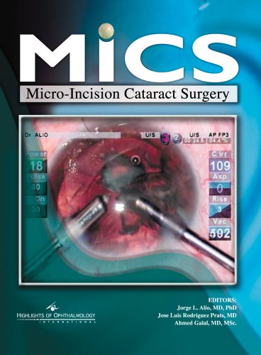 

surgical-sciences/ophthalmology/mics-micro-incision-cataract-surgery-9789962613305